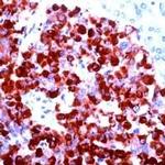 Chromogranin A Antibody in Immunohistochemistry (IHC)