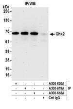 Chk2 Antibody in Western Blot (WB)