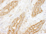 Coronin 2 Antibody in Immunohistochemistry (IHC)