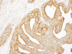 Coronin 2 Antibody in Immunohistochemistry (IHC)