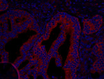 Coronin 2 Antibody in Immunohistochemistry (IHC)