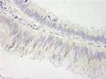 Cul3 Antibody in Immunohistochemistry (IHC)