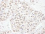 Cyclin T1 Antibody in Immunohistochemistry (IHC)