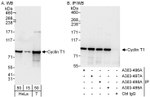 Cyclin T1 Antibody in Western Blot (WB)
