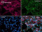 Cytochrome C Antibody in Immunocytochemistry (ICC/IF)