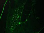 Cytokeratin 8 Antibody in Immunohistochemistry (IHC)