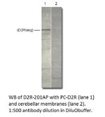 Dopamine D2 Receptor Antibody in Western Blot (WB)