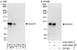 DACH1 Antibody in Western Blot (WB)