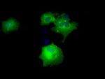 DAPK2 Antibody in Immunocytochemistry (ICC/IF)