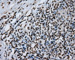 DAPK2 Antibody in Immunohistochemistry (Paraffin) (IHC (P))