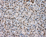 DAPK2 Antibody in Immunohistochemistry (Paraffin) (IHC (P))