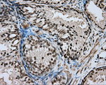 DAPK2 Antibody in Immunohistochemistry (Paraffin) (IHC (P))