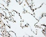 DAPK2 Antibody in Immunohistochemistry (Paraffin) (IHC (P))