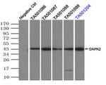 DAPK2 Antibody in Immunoprecipitation (IP)