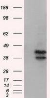 DAPK2 Antibody in Western Blot (WB)