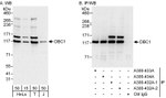 DBC1/p30 DBC Antibody in Western Blot (WB)