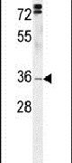 HMCES Antibody in Western Blot (WB)