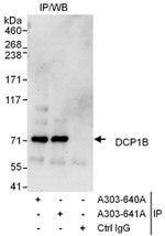 DCP1B Antibody in Immunoprecipitation (IP)