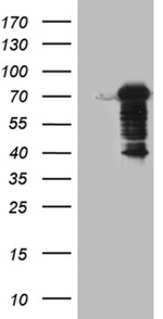 DCP1B Antibody in Western Blot (WB)