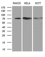 DCP1B Antibody in Western Blot (WB)