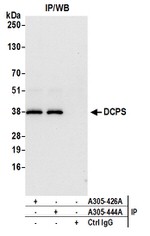 DCPS Antibody in Immunoprecipitation (IP)
