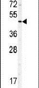 Doublecortin Antibody in Western Blot (WB)