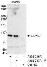 DDX27 Antibody in Immunoprecipitation (IP)