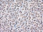 DDX39B Antibody in Immunohistochemistry (Paraffin) (IHC (P))