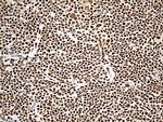 DDX39B Antibody in Immunohistochemistry (Paraffin) (IHC (P))