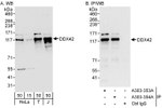 DDX42 Antibody in Western Blot (WB)