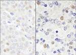 DDX46 Antibody in Immunohistochemistry (IHC)