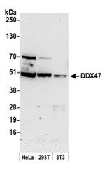 DDX47 Antibody in Western Blot (WB)