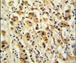 DDX49 Antibody in Immunohistochemistry (IHC)