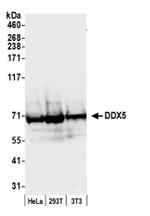 DDX5 Antibody in Western Blot (WB)