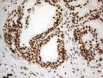 DDX50 Antibody in Immunohistochemistry (Paraffin) (IHC (P))