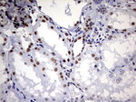 DDX56 Antibody in Immunohistochemistry (Paraffin) (IHC (P))