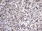 DDX56 Antibody in Immunohistochemistry (Paraffin) (IHC (P))