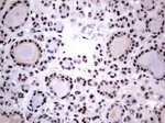 DDX56 Antibody in Immunohistochemistry (Paraffin) (IHC (P))