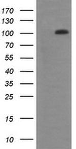 DDX58 Antibody in Western Blot (WB)