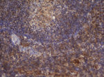 DDX59 Antibody in Immunohistochemistry (Paraffin) (IHC (P))