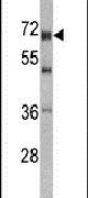 DDX5 Antibody in Western Blot (WB)