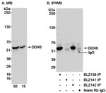 DDX6 Antibody in Western Blot (WB)