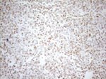 DECR1 Antibody in Immunohistochemistry (Paraffin) (IHC (P))