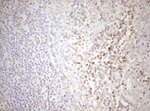 DECR1 Antibody in Immunohistochemistry (Paraffin) (IHC (P))