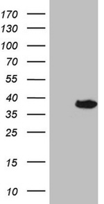 DECR1 Antibody in Western Blot (WB)