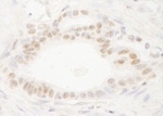 DEK Antibody in Immunohistochemistry (IHC)