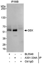 DEK Antibody in Immunoprecipitation (IP)