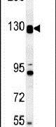 DENND5B Antibody in Western Blot (WB)