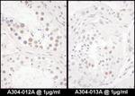 DENTT Antibody in Immunohistochemistry (IHC)