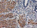 DES Antibody in Immunohistochemistry (Paraffin) (IHC (P))